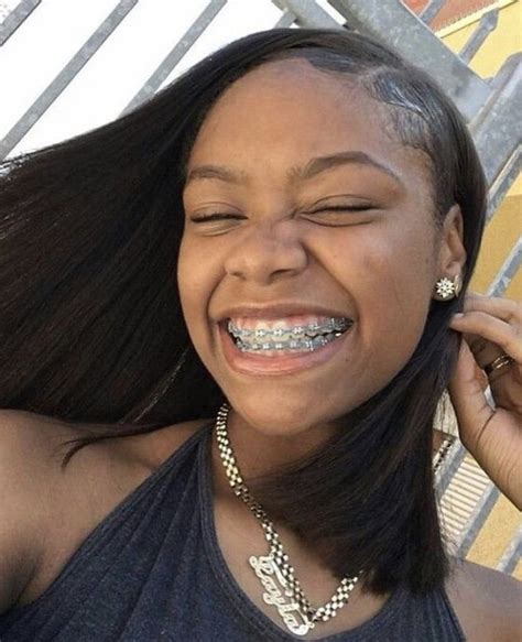 Famous Best Braces Colors For Brown Skin References