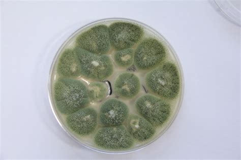 A. flavus Archives - Aspergillus and Aspergillosis