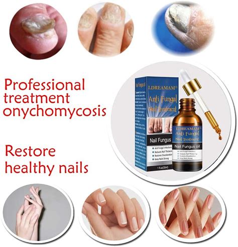 Buy Fungal Nail Treatment,Toenail Fungus Treatment,Antifungal Treatment ...