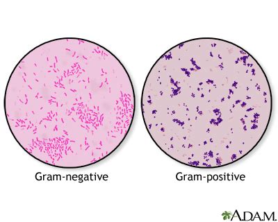 Industrial & Scientific Bacteria Types Slide Gram Stain Separate Smears ...