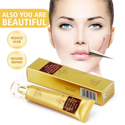 Stretch Marks Remove Acne Scar Treatment Cream Face Whitening Cream ...