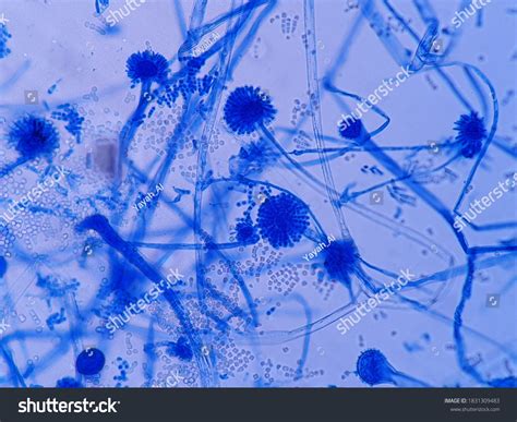 Aspergillus spp : 31 images, photos et images vectorielles de stock ...