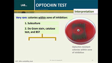 Optochin Test- Streptococcus pneumoniae - YouTube