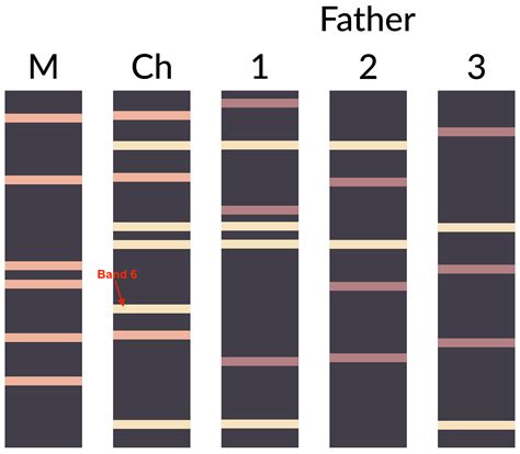 homework - Paternity testing using gel electrophoresis - Biology Stack ...