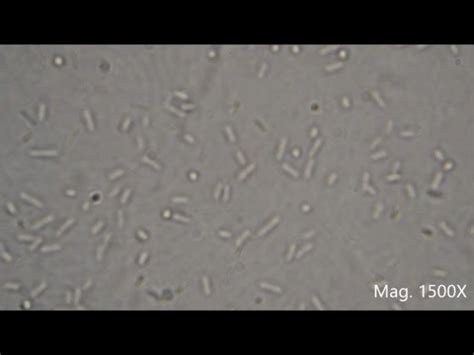 [最も選択された] e coli microscope 284026-E coli under microscope 1000x