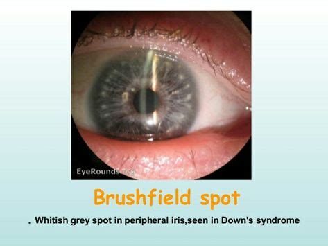 64 Eye : Dots Spots & Lines ideas | dots, spots, eye health