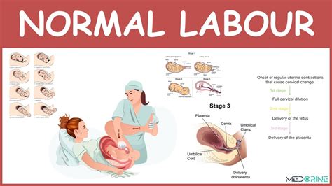 Physiology of Normal Labour, stages, mechanisms and management - YouTube