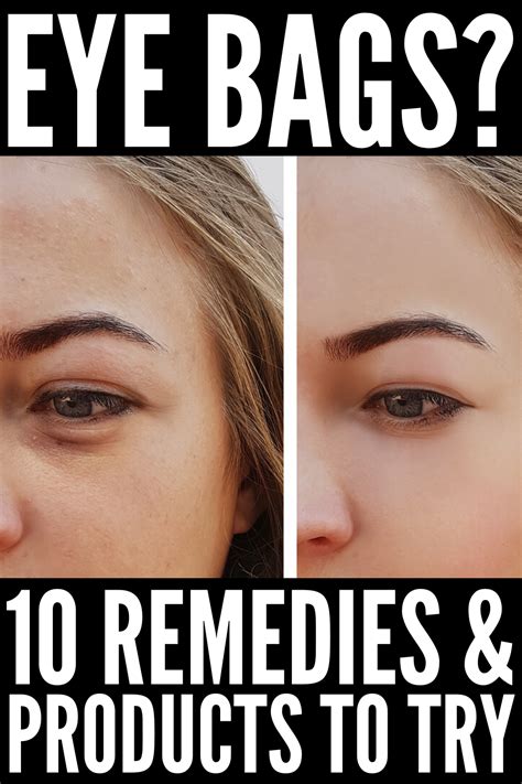 How to Get Rid of Eye Bags: 10 Tips and Tricks that Work! | Eye bags ...