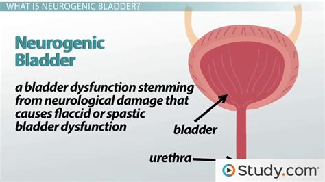 Cystitis and the Neurogenic Bladder - Video & Lesson Transcript | Study.com