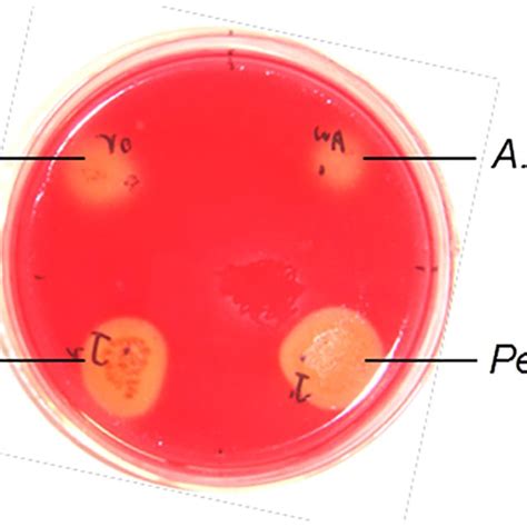 Congo red staining of fungal strains with cellulolytic activity. The ...