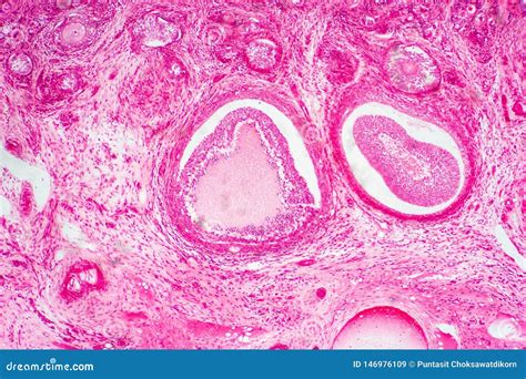 Light Microscopic of Human Ovary Showing Primary and Secondary ...