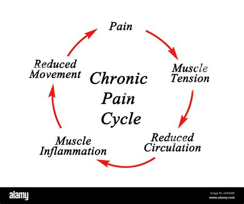 Steps in Chronic Pain Cycle Stock Photo - Alamy