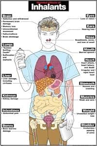 Amazon.com: Harmful Effects of Inhalants 24" X 36" Laminated Poster ...