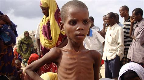 La famine a emporté 258 000 personnes en Somalie | Radio-Canada