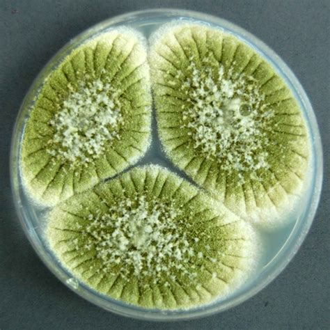 taxonomic name aspergillus flavus description aspergillus flavus colony ...