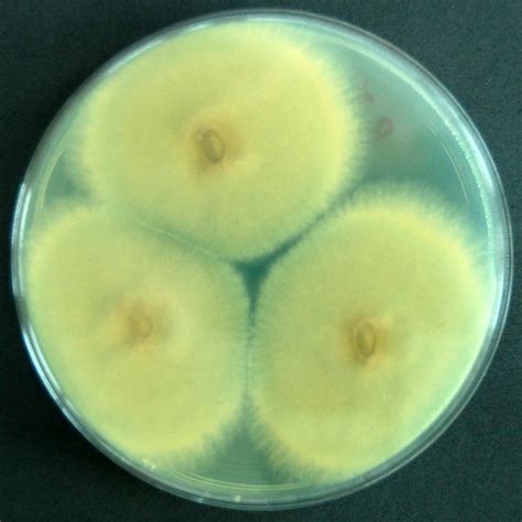 Aspergillus fumigatus