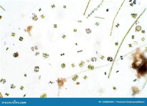 Freshwater Aquatic Plankton Under Microscope View Stock Image ...