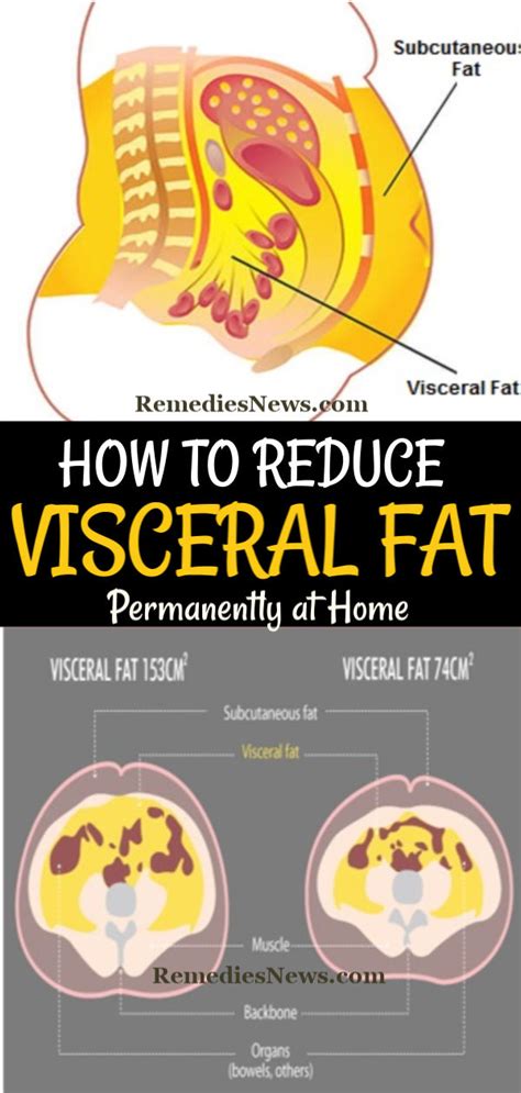 How to Lose Visceral Fat: Apply these 11 Weight Loss Tips to Burn Belly Fat