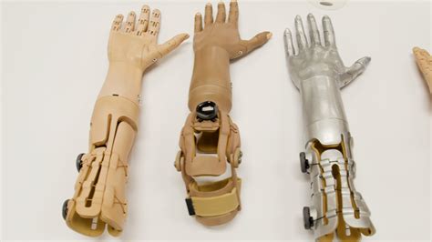 3d Printed Prosthetic Arm