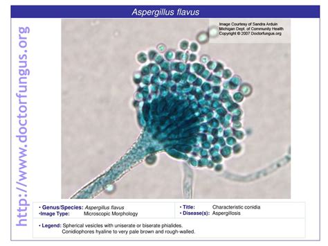 PPT - Aspergillus flavus PowerPoint Presentation, free download - ID ...