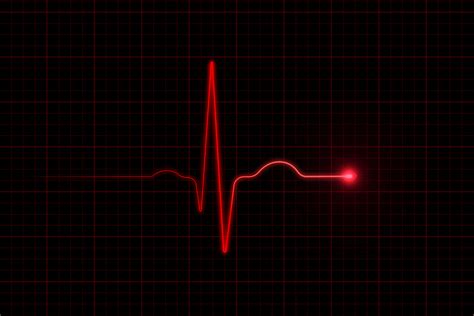 Heart Arrhythmias: Types, Treatment, Signs, and Symptoms