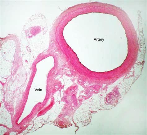 Arteries vs Veins Histology images