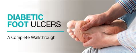 Causes of Diabetic Foot Ulcers and How To Treatment Them