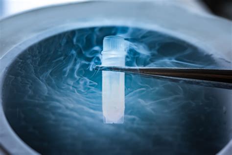 The Ultimate Guide to Egg Freezing