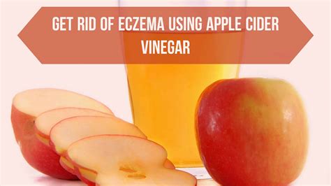 How to Get Rid of Eczema using Apple Cider Vinegar