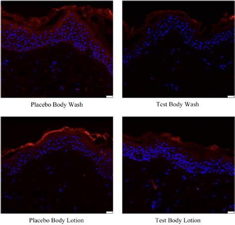 Rhodamine B Fluorescence images of Skin tissues cross sections ...