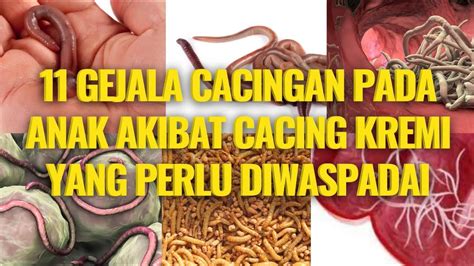 🔥 11 Gejala Cacingan Pada Anak Akibat Cacing Kremi - Ciri-Ciri Anak ...