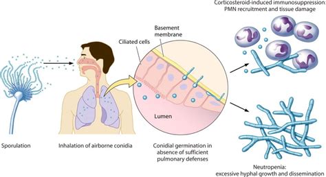 Aspergillus fumigatus- An Overview