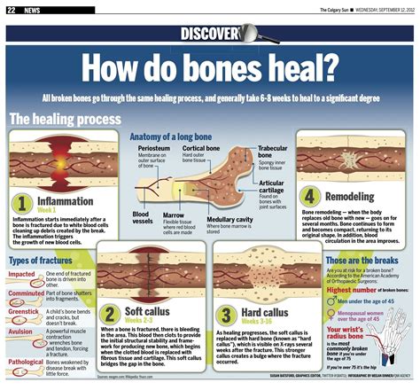 How do bones heal? All broken bones go through the same healing process ...