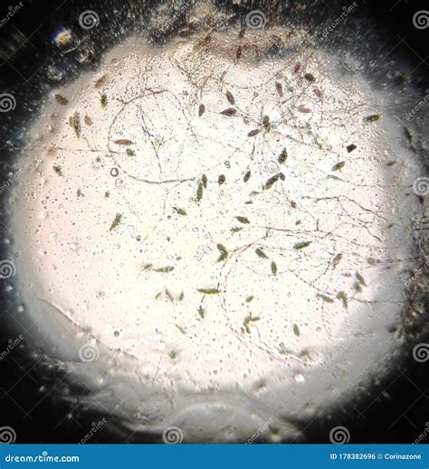 Microscopy of the Alternaria Fungal Mycelium Stock Photo - Image of ...