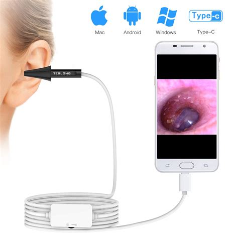 Digital Video Otoscope, ScopeAround Ear Scope Ear Inspection Camera ...