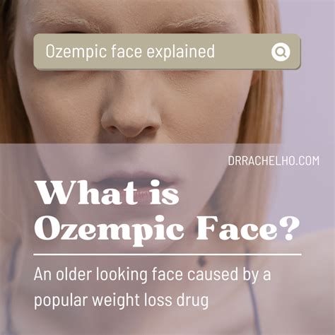 Anne Fisher Headline: Ozempic Face Side Effects