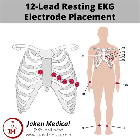 Nursing Notes, Nursing School, 12 Lead Ekg Placement, Ekg Leads ...