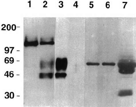 Western Blot Analysis of Membrane-Bound and Soluble Forms of Receptors ...