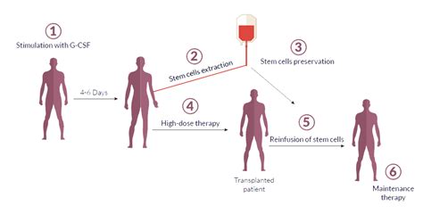 Stem cell transplant – Myeloma Patients Europe