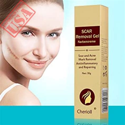 Scar Cream, Acne Scar Removal Cream,Acne Spots Treatment,Stretch Marks ...