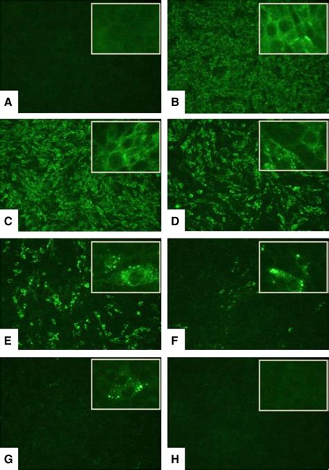 Effects of bufotenine from Anadenanthera colubrine on fluorescence ...