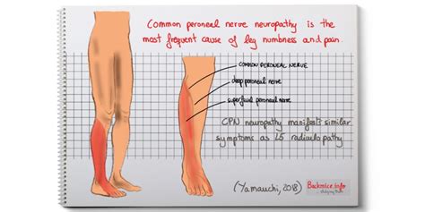 2018 Yamouchi – Undiagnosed peripheral nerve | backmice.info