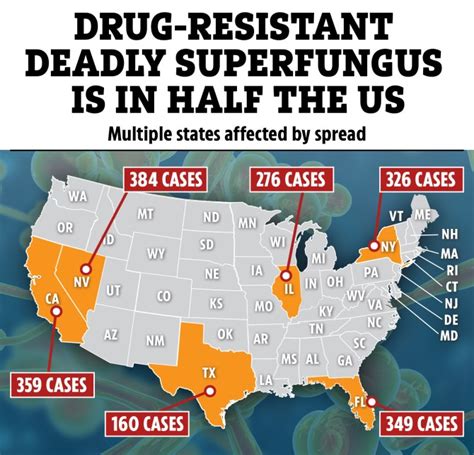 Drug-resistant deadly super fungus spreads to half of US states - see ...