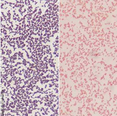 7 Tips To Stop False Gram-Negative Stains • Ethos Biosciences