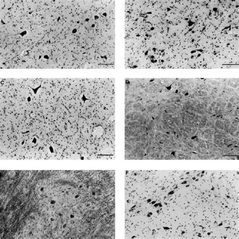 Space arrangement and length of the vestibular nuclei. | Download ...