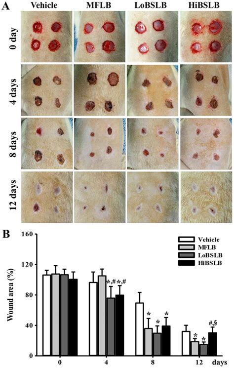 The Best 5 Wound Skin Biopsy Healing Pictures - aethercloudesz