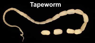 Tapeworms in Humans: Symptoms and Treatments (Pictures Included)