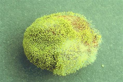 Aspergillus flavus - Alchetron, The Free Social Encyclopedia