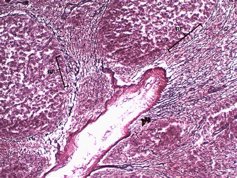 Reticular Connective Tissue 10x | Histology