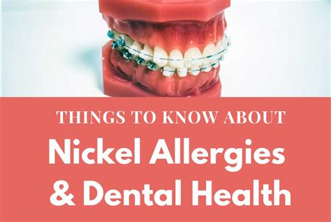 Nickel Allergies and Dental Health – Nickel Food Allergy